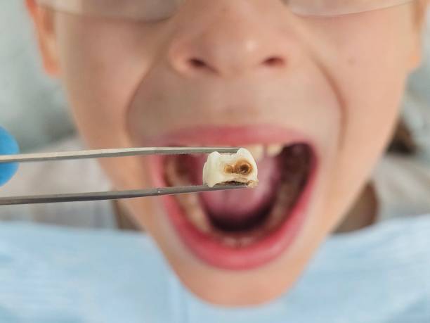 Best Knocked-Out Tooth Emergency  in Wescosville, PA