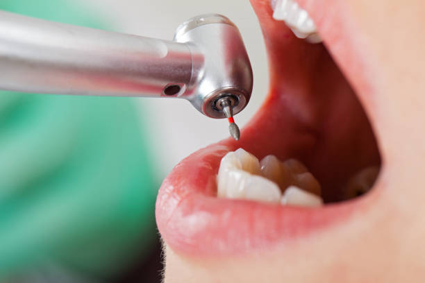 Best Tooth Infection Emergency Dentist  in Wescosville, PA
